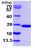 SDS-PAGE - Recombinant Human NUDT16 protein (AB103059)