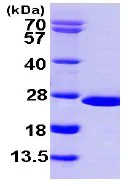 SDS-PAGE - Recombinant Human NUDT16 protein (His tag N-Terminus) (AB103059)