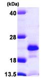 SDS-PAGE - Recombinant Human NUDT2 protein (His tag N-Terminus) (AB103048)