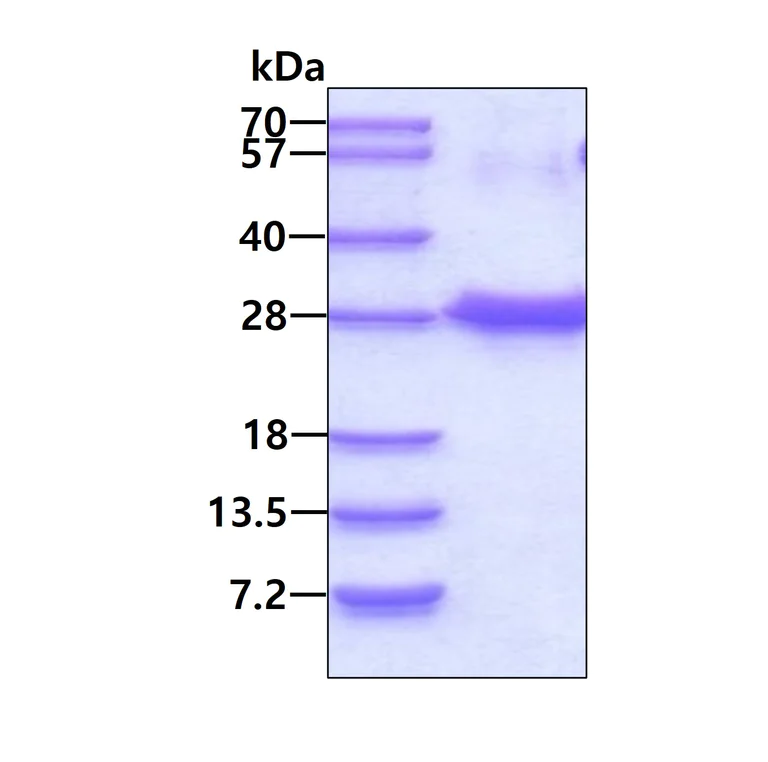 SDS-PAGE - Recombinant Human NUDT4 protein (AB156348)