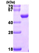 SDS-PAGE - Recombinant Human NUDT9 protein (His tag N-Terminus) (AB107153)
