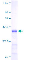 SDS-PAGE - Recombinant Human NUMB protein (AB131949), expandable thumbnail