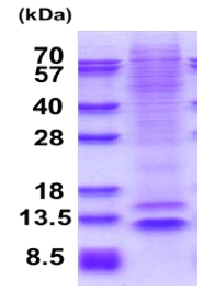 SDS-PAGE - Recombinant Human NUP62CL protein (denatured) (AB177611)