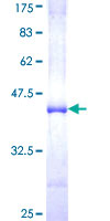 SDS-PAGE - Recombinant Human NUP98 protein (AB159019), expandable thumbnail