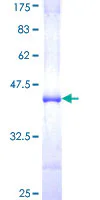 SDS-PAGE - Recombinant Human NUP98 protein (GST tag N-Terminus) (AB159019)
