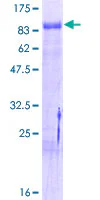 SDS-PAGE - Recombinant Human NUR77 protein (AB114315)