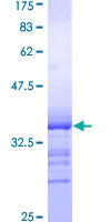 Recombinant Human NUR77 protein
