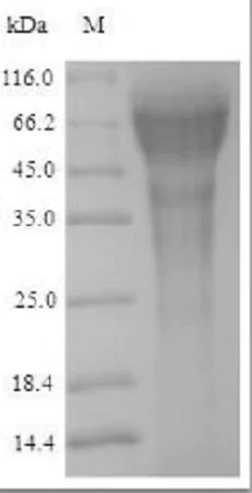 SDS-PAGE - Recombinant Human Nurr1 protein (His tag) (AB241530)