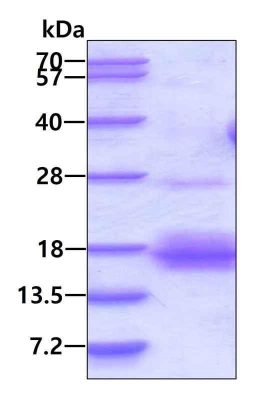 SDS-PAGE - Recombinant Human NXT1 protein (AB107147)