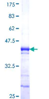 SDS-PAGE - Recombinant Human NY-BR-1 protein (AB164840)