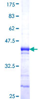 SDS-PAGE - Recombinant Human NY-BR-1 protein (AB164840)