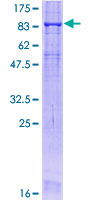 SDS-PAGE - Recombinant Human Occludin protein (AB114189)