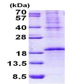 SDS-PAGE - Recombinant Human OCIAD2 protein (denatured) (His tag N-Terminus) (AB156356)