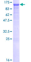 SDS-PAGE - Recombinant Human OGT / O-Linked N-Acetylglucosamine Transferase protein (AB131881)