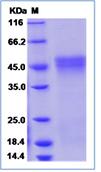SDS-PAGE - Recombinant Human OIF protein (His tag) (AB276546), expandable thumbnail