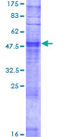 SDS-PAGE - Recombinant Human Olfactory receptor 10X1 protein (AB165297), expandable thumbnail