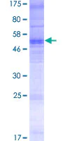 SDS-PAGE - Recombinant Human Olfactory receptor 13C8 protein (AB165424)
