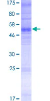 SDS-PAGE - Recombinant Human Olfactory receptor 13C8 protein (GST tag N-Terminus) (AB165424)