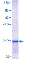 SDS-PAGE - Recombinant Human Olfactory receptor 2A2 protein (AB166553), expandable thumbnail