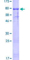 SDS-PAGE - Recombinant Human OLFM4 protein (AB112393), expandable thumbnail