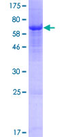 SDS-PAGE - Recombinant Human OLFML3 protein (AB163444), expandable thumbnail
