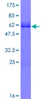 SDS-PAGE - Recombinant Human Olig3 protein (GST tag N-Terminus) (AB165797)