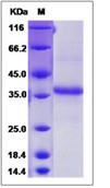 SDS-PAGE - Recombinant Human Oligodendrocyte Specific Protein (Fc Chimera) (AB276494)