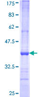 Recombinant Human OP-2 protein