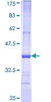 SDS-PAGE - Recombinant Human OP-2 protein (AB116819)