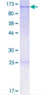 Recombinant Human OPA1 protein