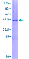 SDS-PAGE - Recombinant Human OPA3 protein (AB164221), expandable thumbnail