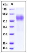 SDS-PAGE - Recombinant Human OPCML protein (His tag) (AB276247)