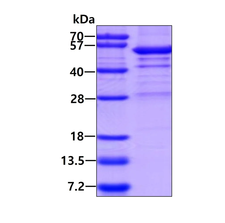 SDS-PAGE - Recombinant Human OPRT protein (denatured) (AB136379)
