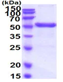 SDS-PAGE - Recombinant Human OPRT protein (His tag) (AB226883)