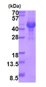 SDS-PAGE - Recombinant Human Opticin protein (denatured) (His tag N-Terminus) (AB202160)