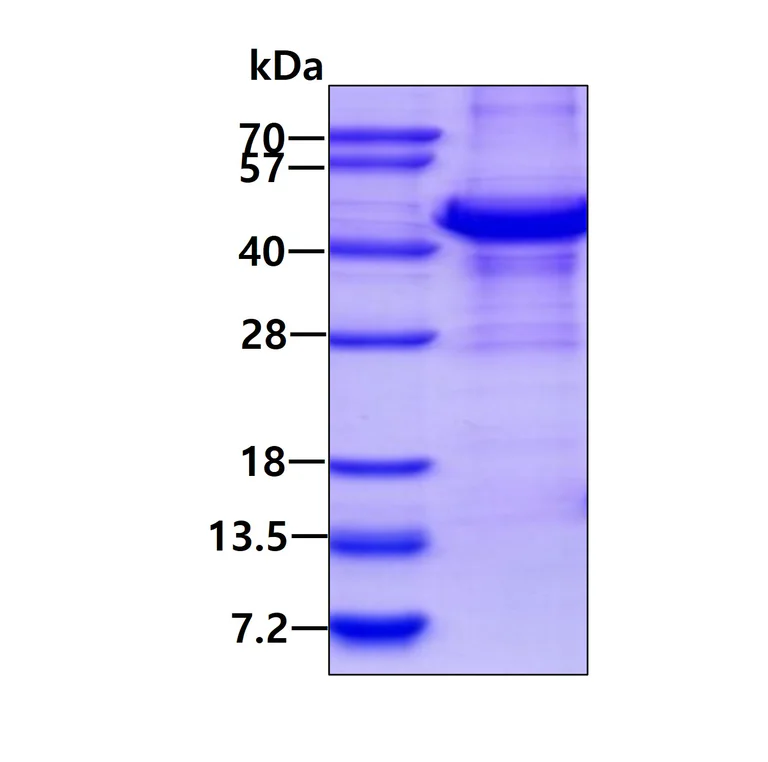 SDS-PAGE - Recombinant Human Opticin protein (denatured) (AB202160)