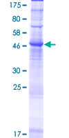 SDS-PAGE - Recombinant Human Orai2 protein (GST tag N-Terminus) (AB164229)