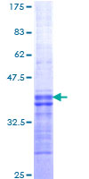 Recombinant Human Orexin Receptor 2 protein