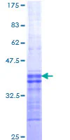 SDS-PAGE - Recombinant Human Orexin Receptor 2 protein (GST tag N-Terminus) (AB112299)