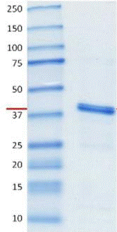 SDS-PAGE - Recombinant Human Ornithine Carbamoyltransferase/OTC protein (AB123452), expandable thumbnail