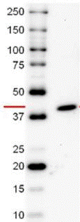 Western blot - Recombinant Human Ornithine Carbamoyltransferase/OTC protein (AB123452), expandable thumbnail