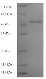 SDS-PAGE - Recombinant Human Ornithine Carbamoyltransferase/OTC protein (Tagged) (AB235822)