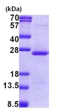 SDS-PAGE - Recombinant Human Orosomucoid 2 protein (denatured) (AB167843)