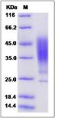 SDS-PAGE - Recombinant Human Orosomucoid 2 protein (His tag) (AB276527)