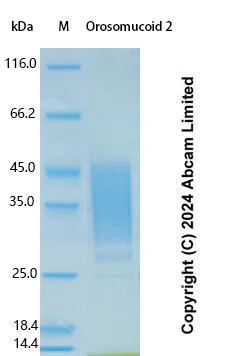 SDS-PAGE - Recombinant Human Orosomucoid 2 Protein Standard (His tag) (AB323162)