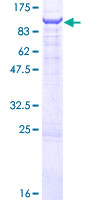 Recombinant Human OSBPL9 protein