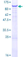 SDS-PAGE - Recombinant Human OSBPL9 protein (AB165052)