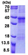 SDS-PAGE - Recombinant Human OSCAR/Osteoclast-associated receptor protein (denatured) (His tag N-Terminus) (AB156742)