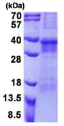 SDS-PAGE - Recombinant Human OSCAR/Osteoclast-associated receptor protein (denatured) (His tag N-Terminus) (AB156742)