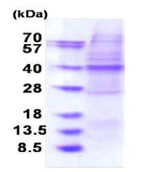 SDS-PAGE - Recombinant Human OSGEP protein (denatured) (His tag N-Terminus) (AB183238)